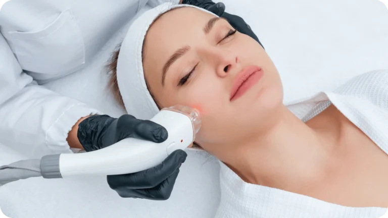 Dịch vụ Điều trị da mụn, rỗ, thâm mụn