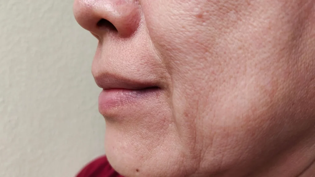 Lão Hóa ảnh Hưởng đến đường Viền Hàm Như Thế Nào