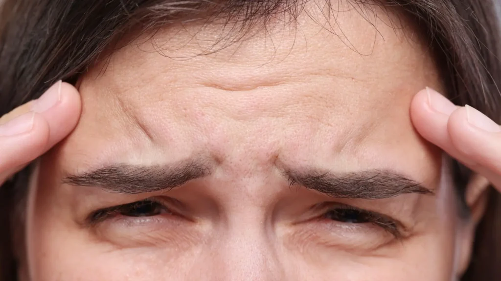 Những Thói Quen Khiến Vùng Trán Lão Hóa Sớm