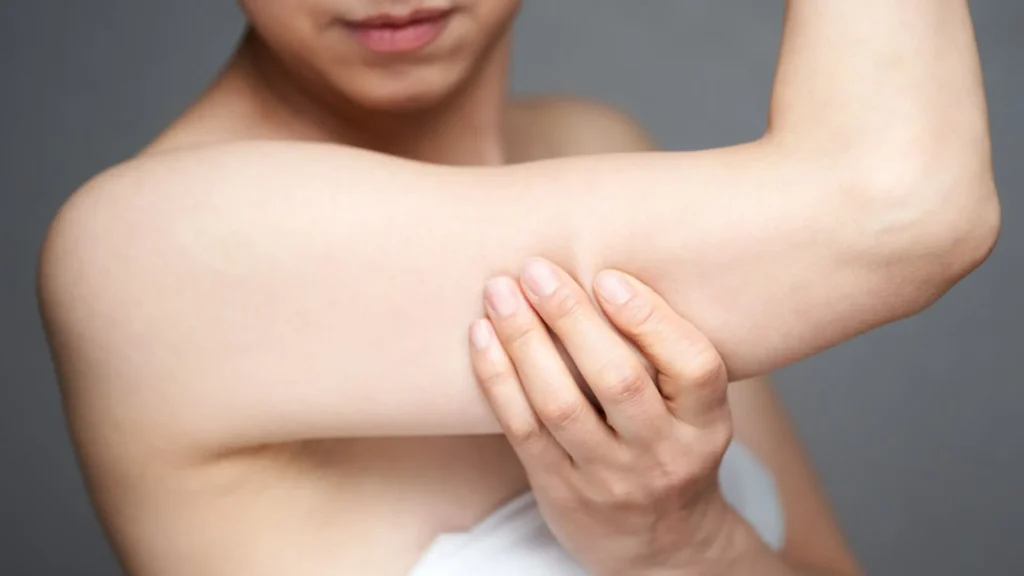 Tiêm Filler Bắp Tay Là Gì Có Nguy Hiểm Không