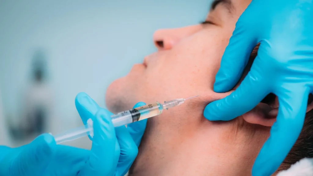 Tiêm Filler Viền Hàm Là Gì Có Bao Nhiêu Loại Filler Cho Hàm
