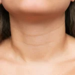Vì Sao Vùng Cổ Mất độ đàn Hồi Theo Tuổi Tác